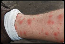 مكافحة الحشرات